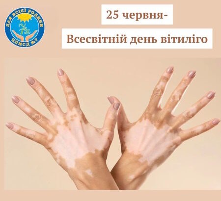 Всесвітній день вітиліго: руйнуємо міфи та підтримуємо обізнаність